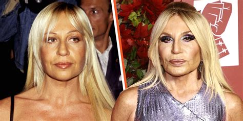 donatella versace nose|donatella versace personal life.